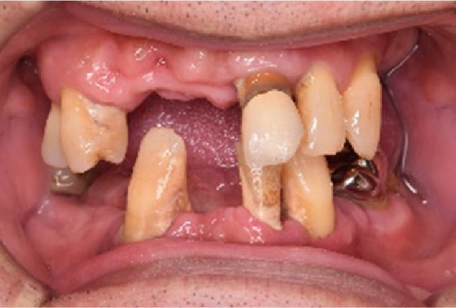 CASE 01