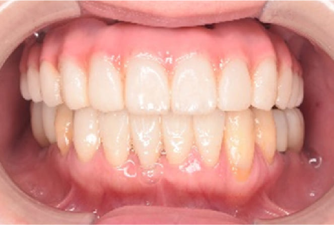 CASE 01