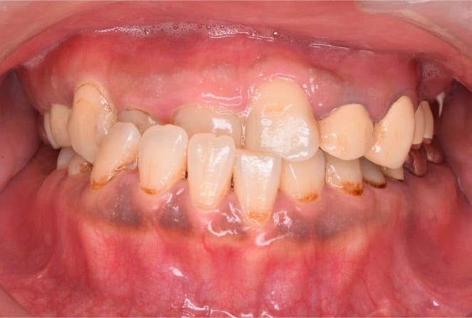 CASE 02