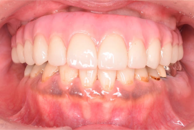 CASE 02