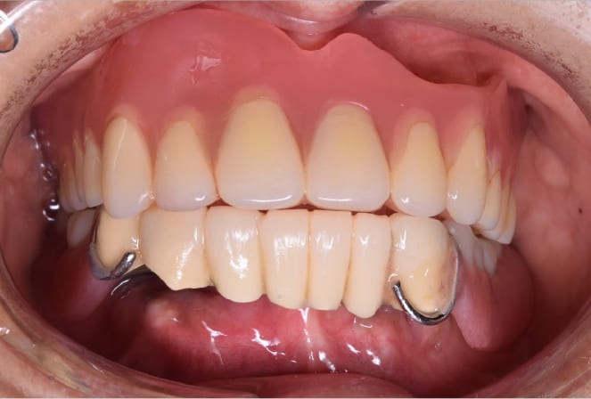 CASE 03