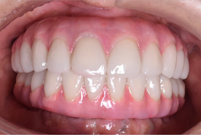 CASE 03