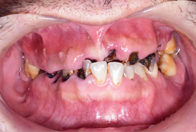 CASE 04