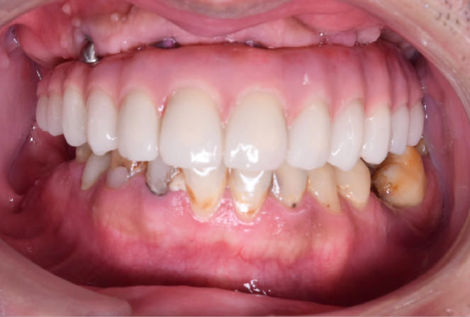 CASE 04