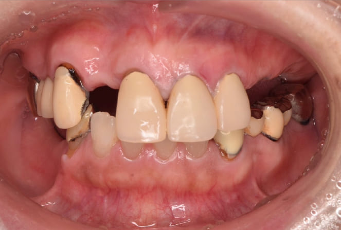 CASE 05