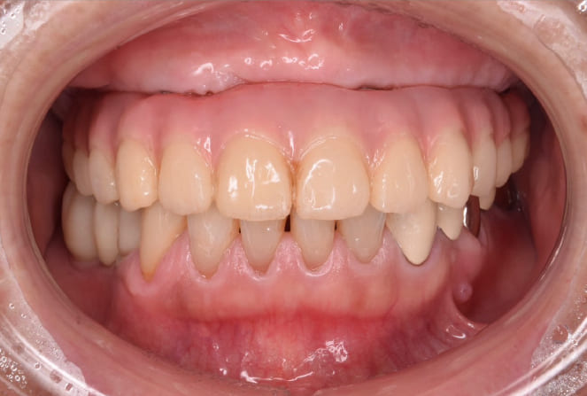 CASE 05